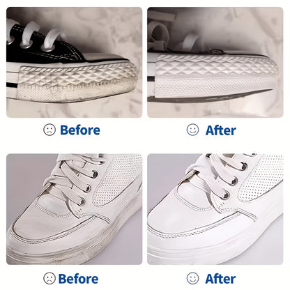 10.14oz No-Rinse Professional Shoe Cleaner Foam - Powerful Stain & Black Spot Remover, Fast-Acting Formula for All Shoe Types, Waterless & Easy
